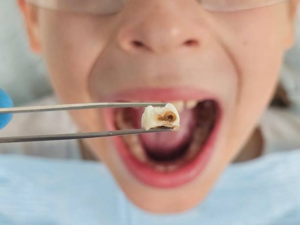 Best Mobile Emergency Dentist in Mart, TX